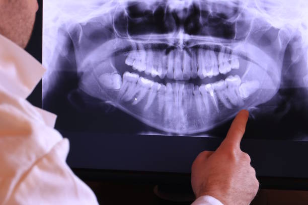 Best Emergency Dental Care for Trauma or Injury in Mechanicsville, MD